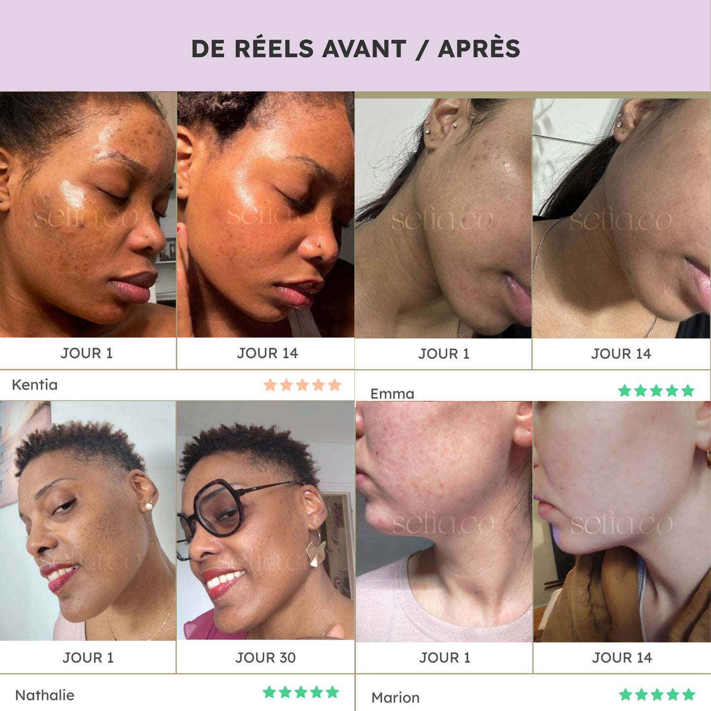 Ultra Glow - Rutina de 6 productos