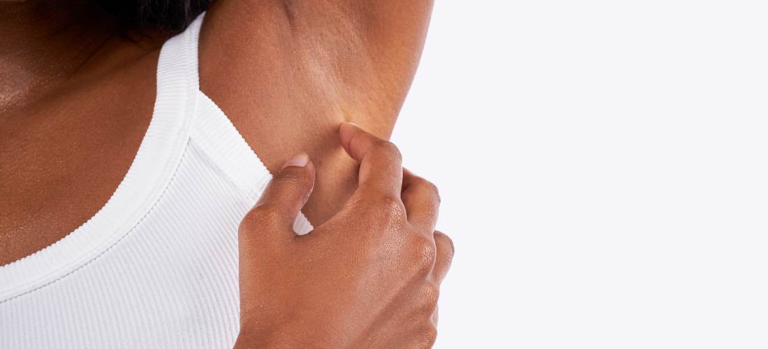 Aisselles foncées et taches entre les cuisses : causes, erreurs à éviter et solutions Imagen
