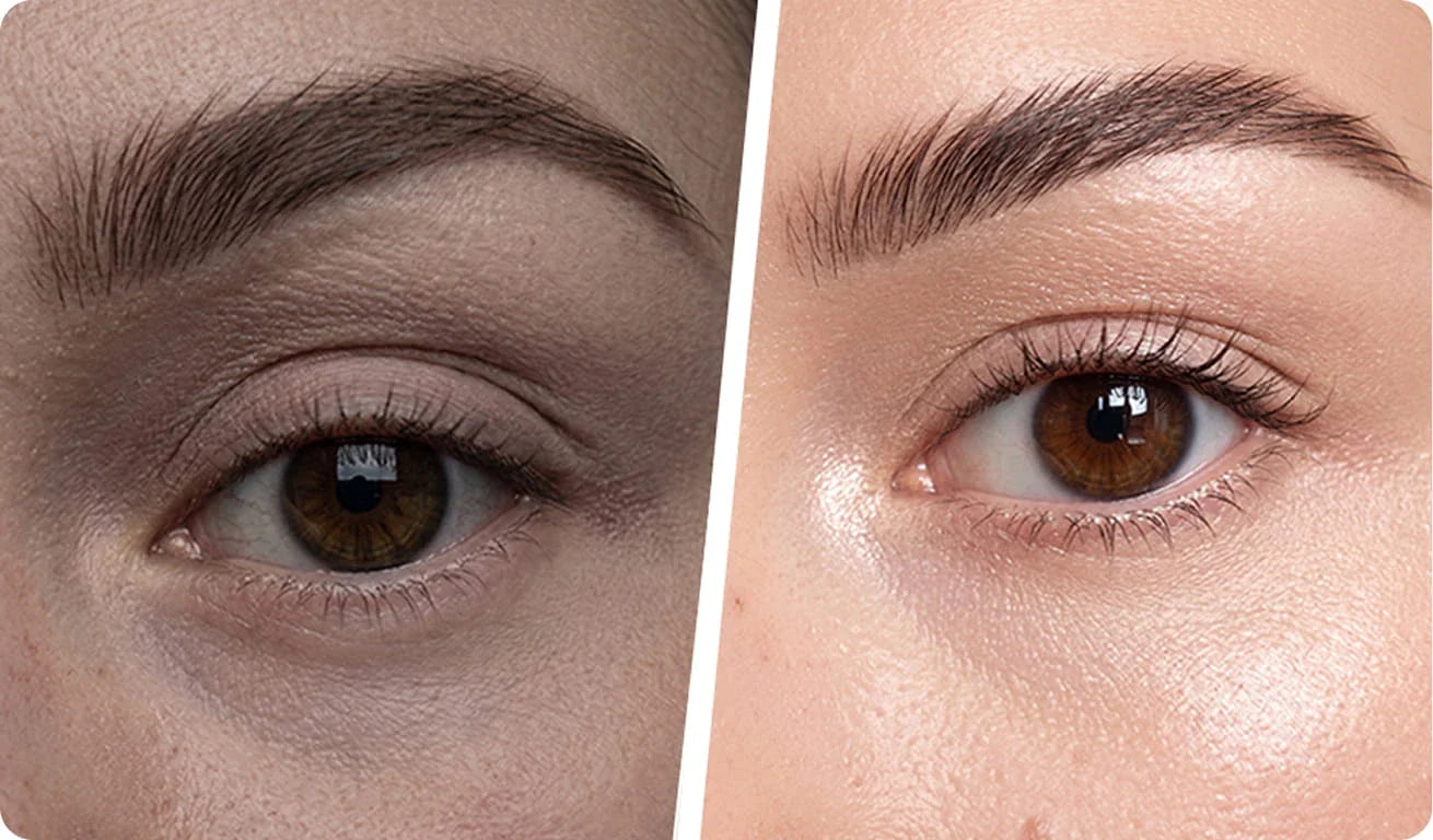 Meilleur patch yeux : comment reconnaître un patch anti-cernes efficace Imagen