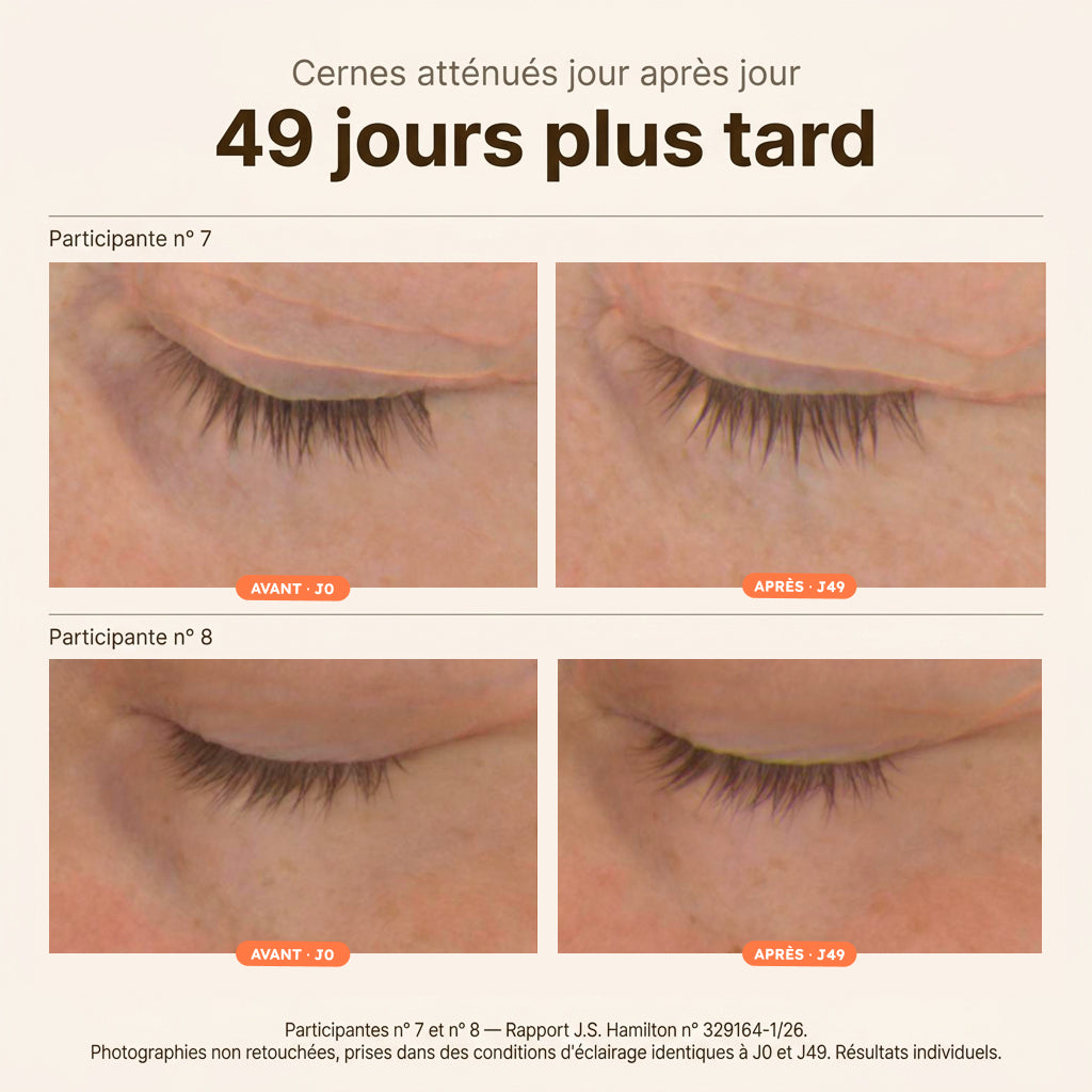 Parche anti-ojeras