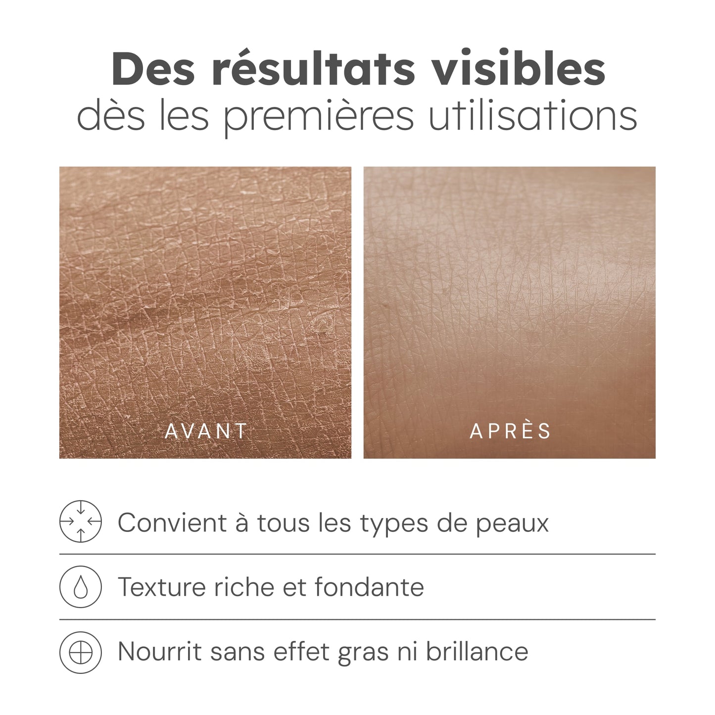 Hidratante Antimanchas - 50g