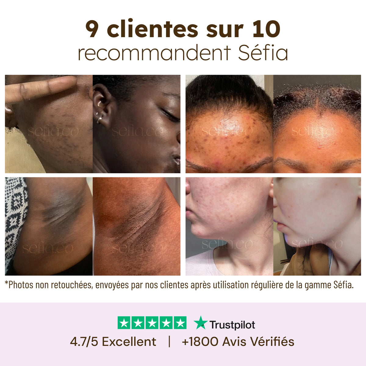 Bálsamo mascarilla nutritiva para labios