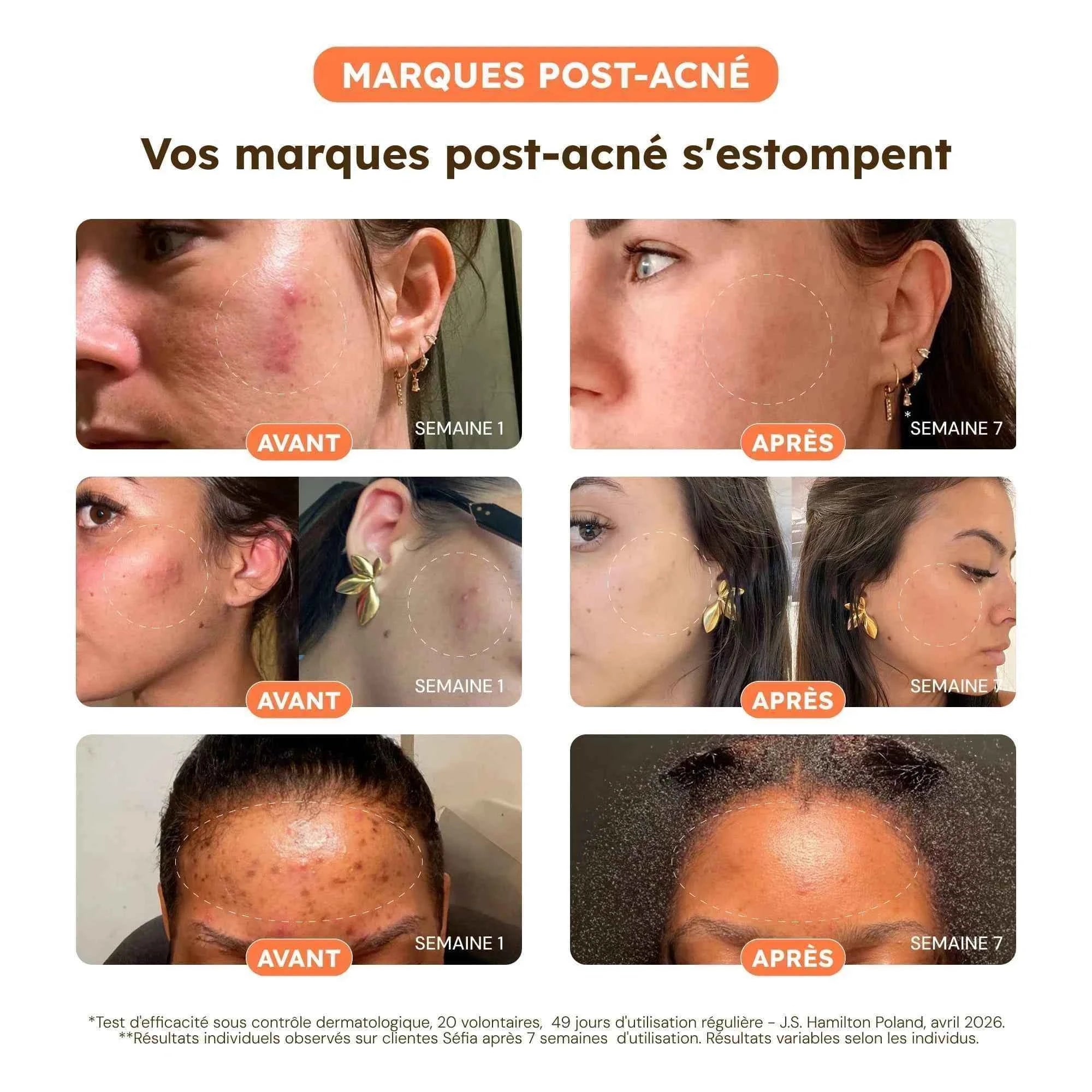 Cotons Anti-Taches - Test V3-2