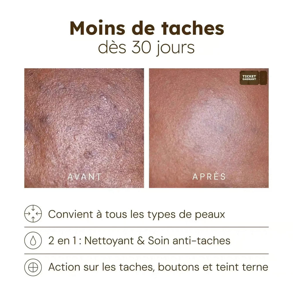 Cotons Anti-Imperfections (old)