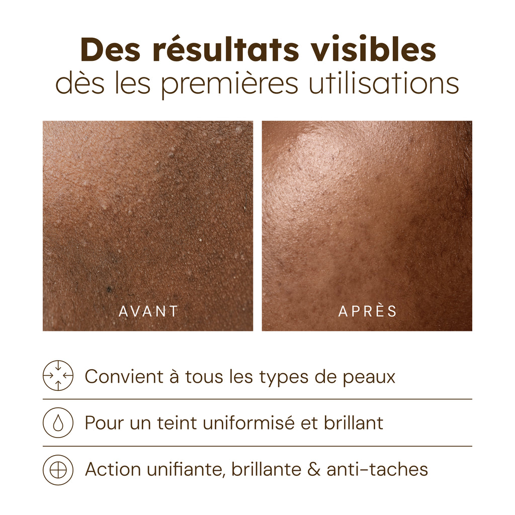 Aceite facial de cúrcuma