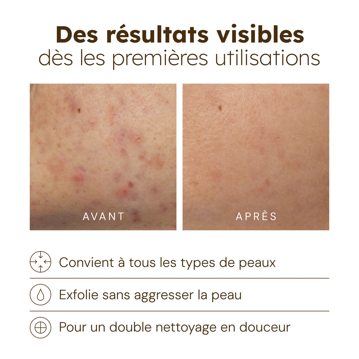 Limpiador Resplandor Cúrcuma - 100ml